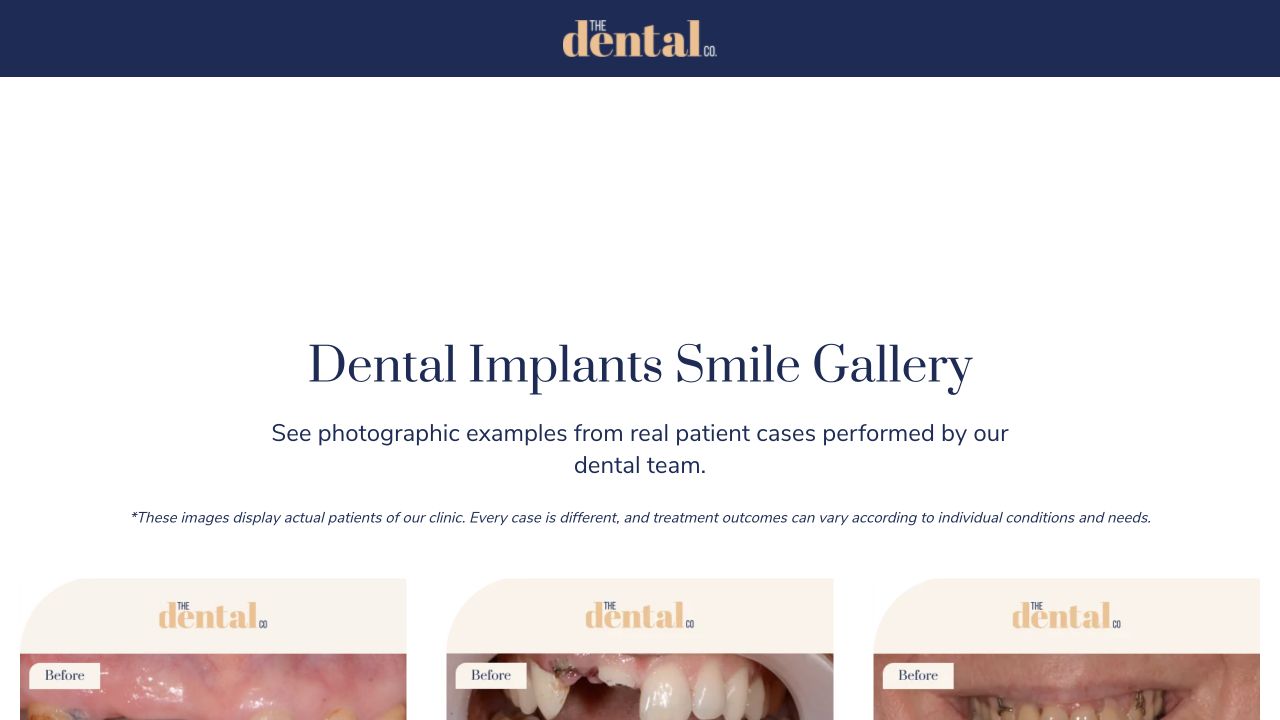 Front of The Dental Co. Dental Implants landing page